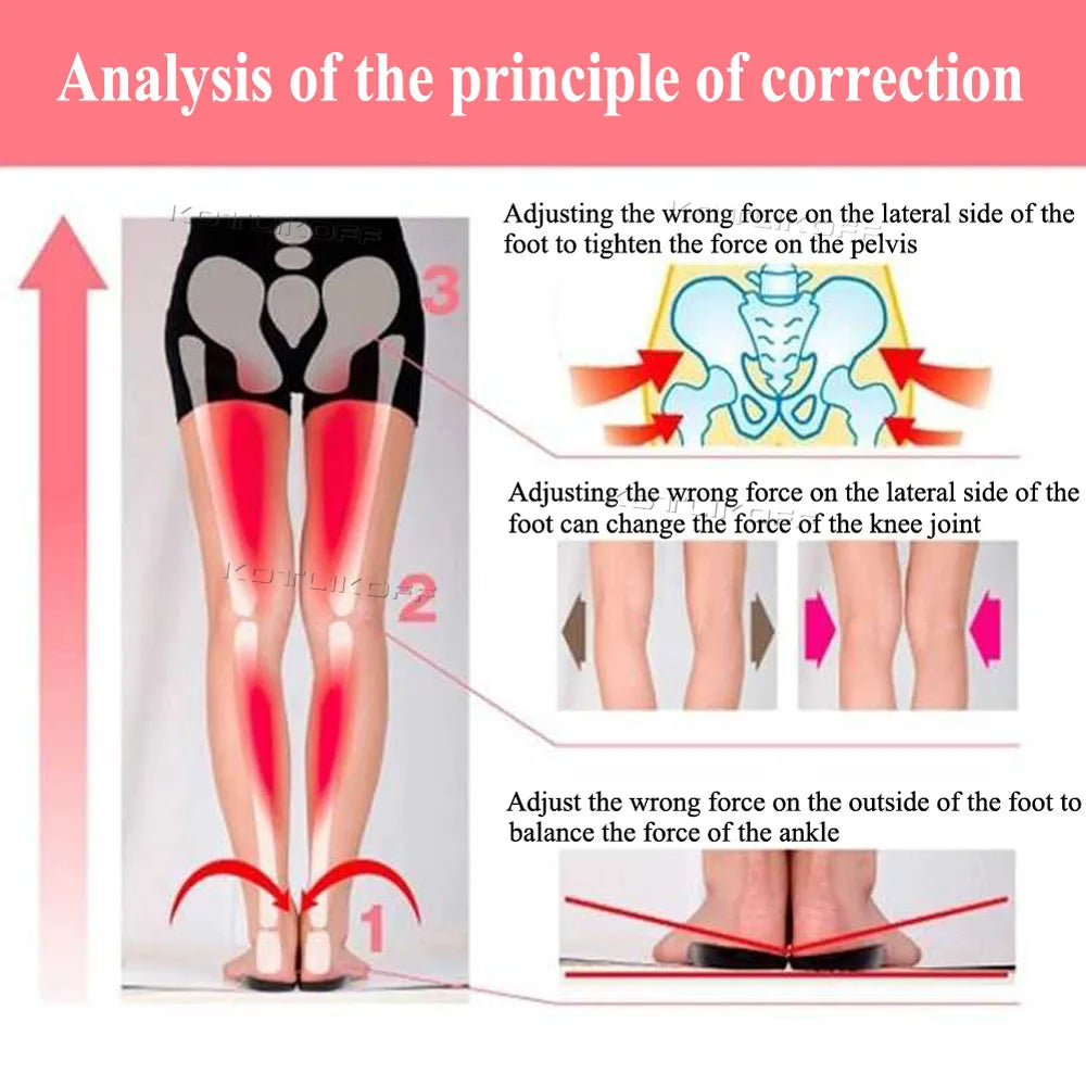 Unisex O/X Leg Valgus Varus Corrector Orthotic Insoles Foot Pads Heel Correction Pads inside outside Feet Insert Insoles