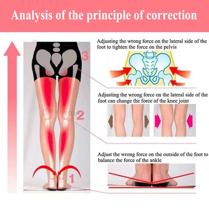 Unisex O/X Leg Valgus Varus Corrector Orthotic Insoles Foot Pads Heel Correction Pads inside outside Feet Insert Insoles