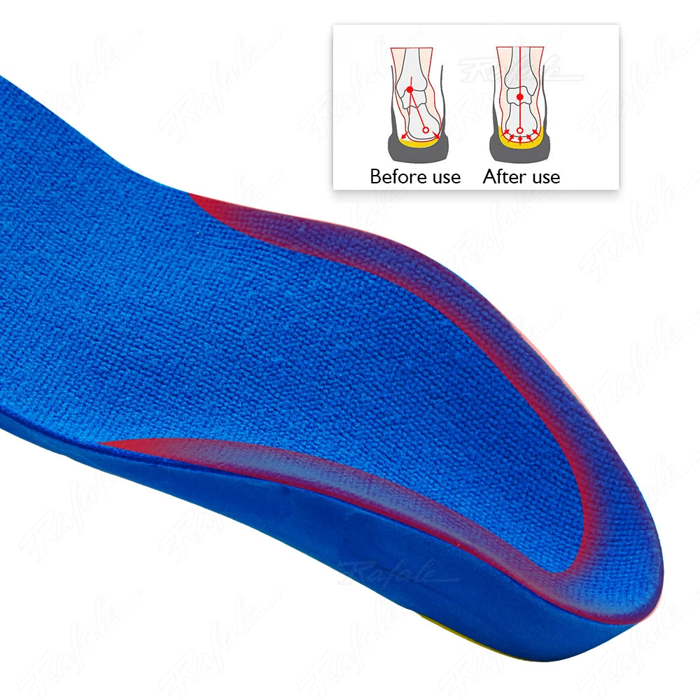 Kids Children Orthotics Insoles Correction Foot Care for Kid Flat Foot Arch Support Orthopedic Insole Soles Sport Shoes Pads
