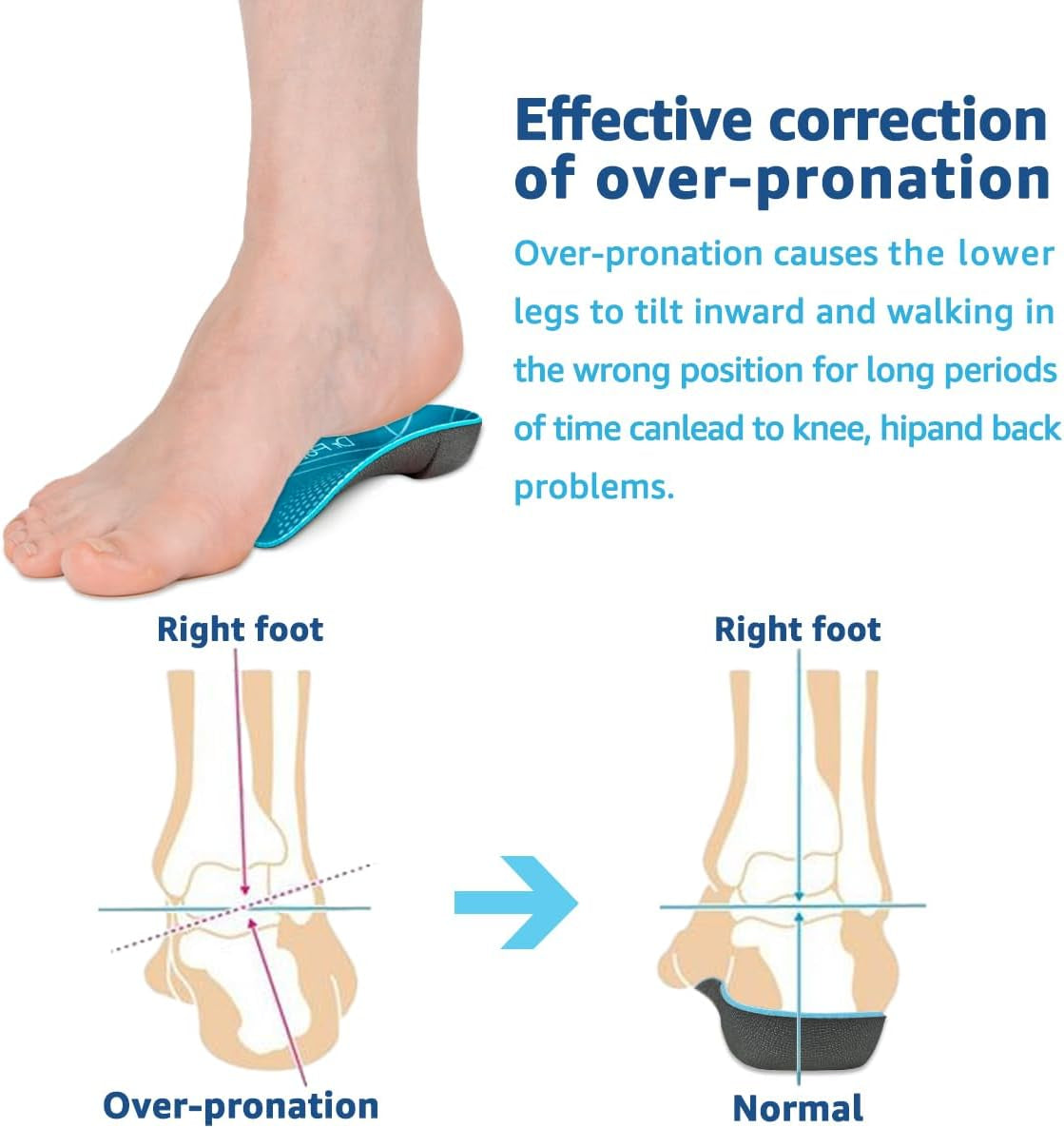 3/4 Orthotic Insoles, Shoe Inserts for Plantar Fasciitis Relief, High Arch Support Inserts for Flat Feet, Over-Pronation and Heel Pain (Medium(Men'S 6.5-8.5 / Women'S 7.5-9.5))